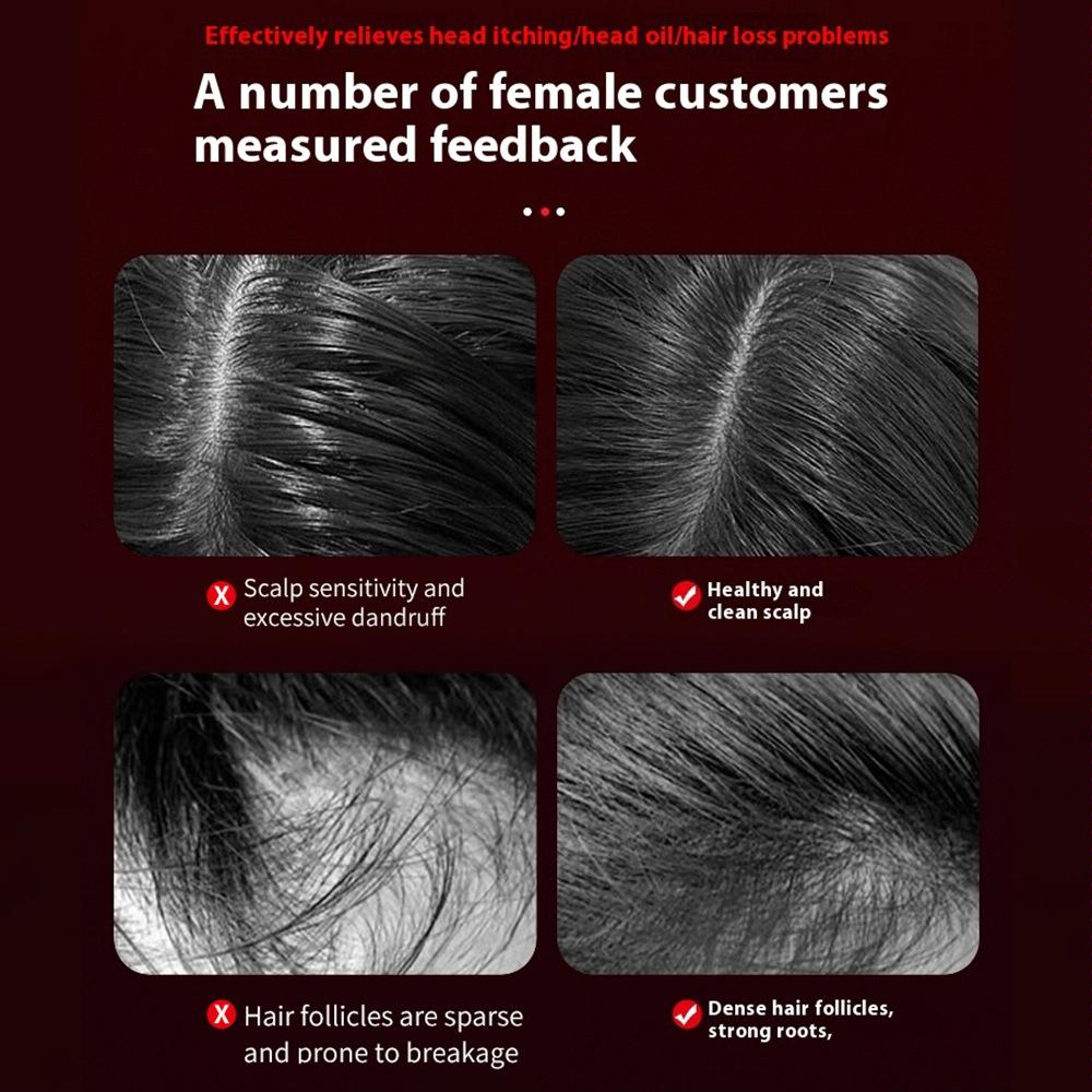 Red Light Scalp Massage Comb For Hair Growth 630Nm Liquid Care - Red