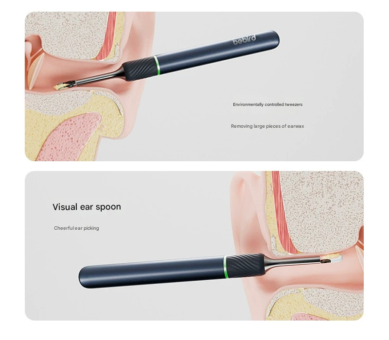 Smart Visual Ear Cleaner with HD Endoscope & Precision Tweezers - Safe for Adults & Children(White)