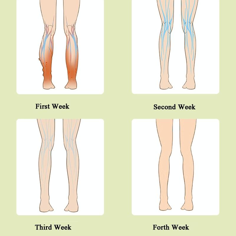 Calf Air Wave Massager Household Varicose Vein Physiotherapy Device Upgrade Fever Type