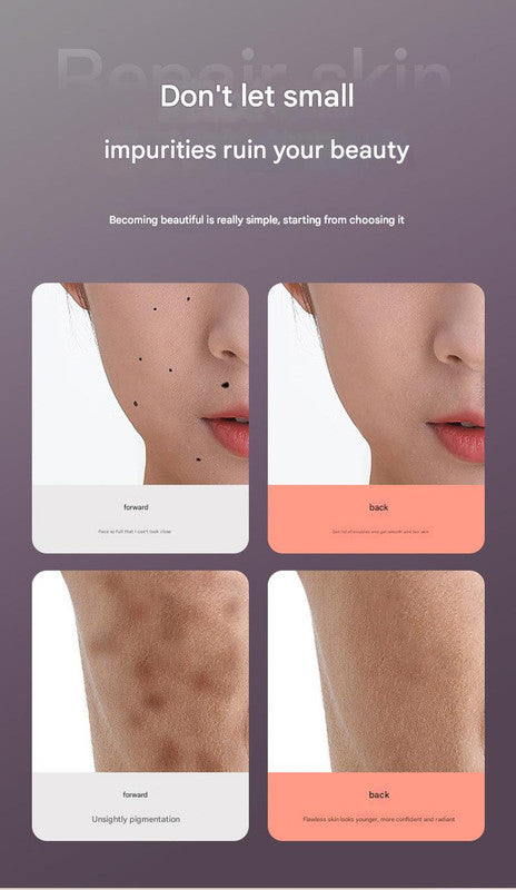 Professional 9-Level Skin Tag & Spot Remover Pen - USB Rechargeable Beauty Device(Silver)