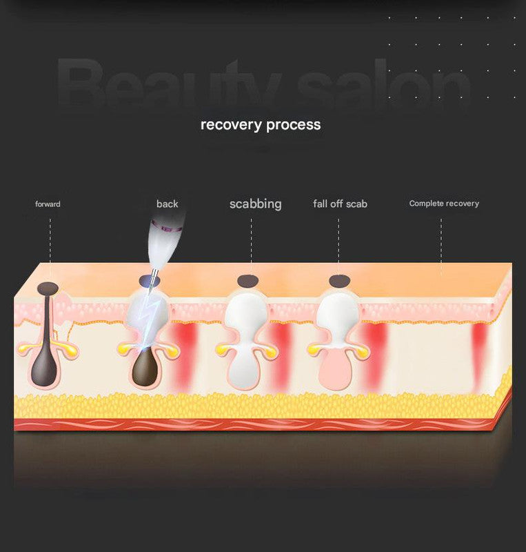 Professional 9-Level Skin Tag & Spot Remover Pen - USB Rechargeable Beauty Device(Silver)