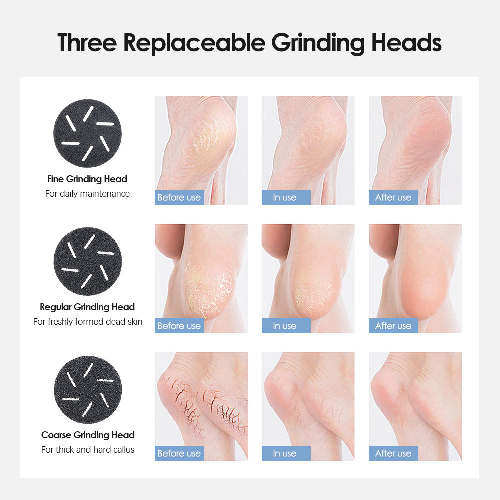 Black Rechargeable Electric Foot Grinder with Suction - Complete 10-Piece Pedicure Kit