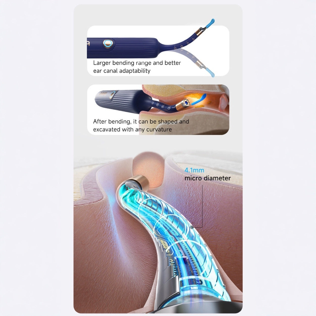 Smart Visual Ear Cleaner with HD Endoscope & Precision Tweezers - Safe for Adults & Children(blue)